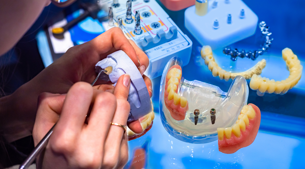stock-photo-dentist-at-work-working-with-the-patient-s-jaw-layout-installation-of-dental-implants-dental-1646372665